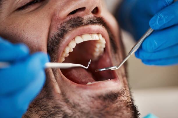 Best Emergency Dental Care for Abscessed Tooth in North Enid, OK