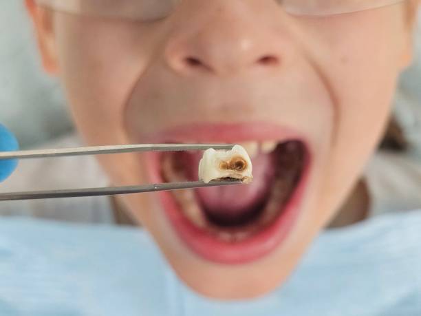Best Pediatric Emergency Dentist in North Enid, OK
