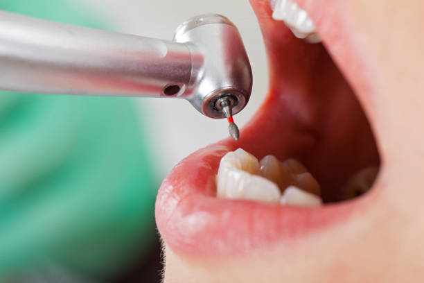 Best Emergency Dental Services for Seniors in North Enid, OK